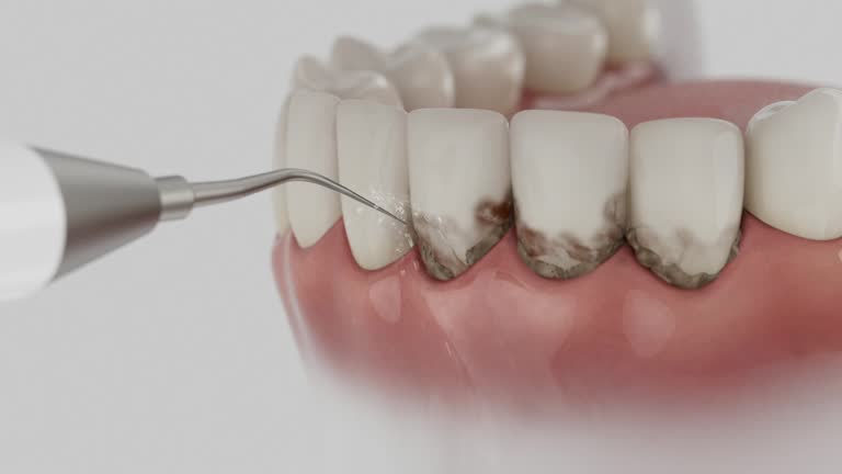 Trusted Dental Crowns And Bridges service in Ashton-Sandy Spring, MD - Dentist Open Now